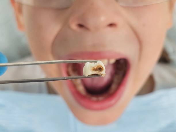 Best Broken or Cracked Tooth Emergency Dentist in New Beaver, PA